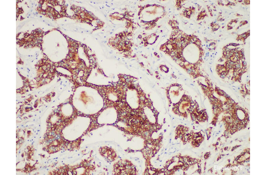Validation Data - Anti-AMACR/p504s Antibody [YN00066m] (A288793)