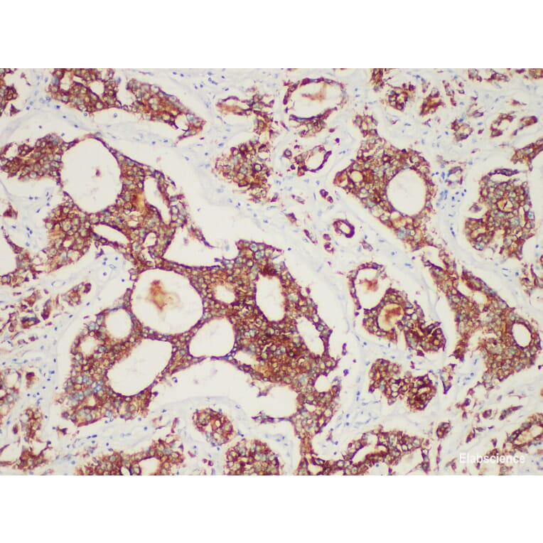 Validation Data - Anti-AMACR/p504s Antibody [YN00066m] (A288793)
