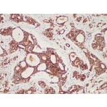 Validation Data - Anti-AMACR/p504s Antibody [YN00066m] (A288793)