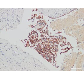 Validation Data - Anti-CA-125 Antibody [YN00125m] (A288795)