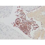 Validation Data - Anti-CA-125 Antibody [YN00125m] (A288795)
