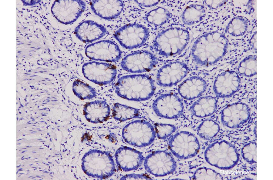 Validation Data - Anti-Chromogranin A Antibody [YN00486r] (A288800)