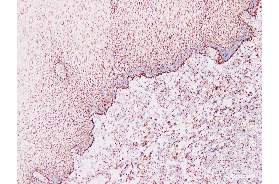 Validation Data - Anti-Cytokeratin 1 Antibody [YN00575m] (A288801)