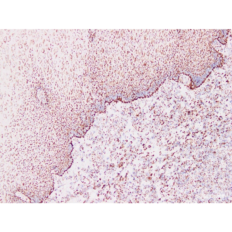 Validation Data - Anti-Cytokeratin 1 Antibody [YN00575m] (A288801)