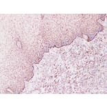 Validation Data - Anti-Cytokeratin 1 Antibody [YN00575m] (A288801)