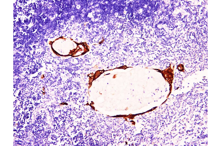 Validation Data - Anti-Cytokeratin 10 Antibody [YN00635m] (A288802)