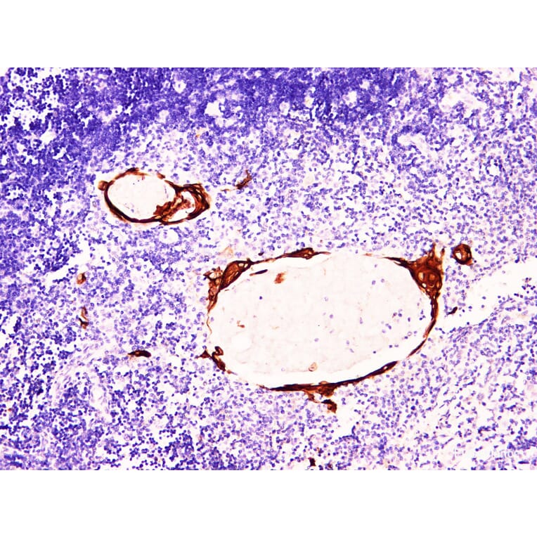 Validation Data - Anti-Cytokeratin 10 Antibody [YN00635m] (A288802)