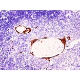 Validation Data - Anti-Cytokeratin 10 Antibody [YN00635m] (A288802)