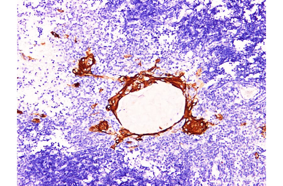 Validation Data - Anti-Cytokeratin 16 Antibody [YN00676m] (A288803)
