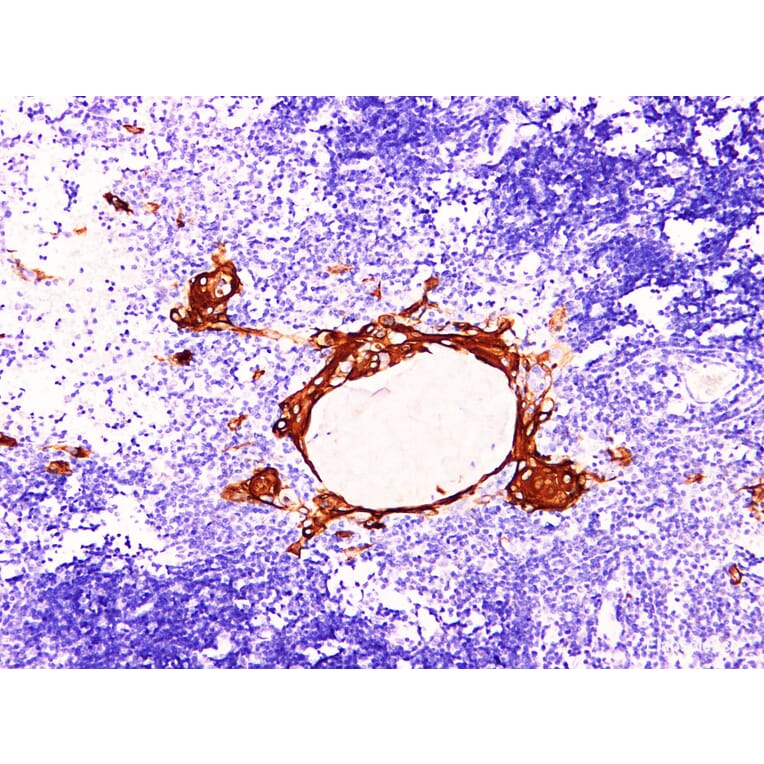 Validation Data - Anti-Cytokeratin 16 Antibody [YN00676m] (A288803)