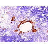 Validation Data - Anti-Cytokeratin 16 Antibody [YN00676m] (A288803)