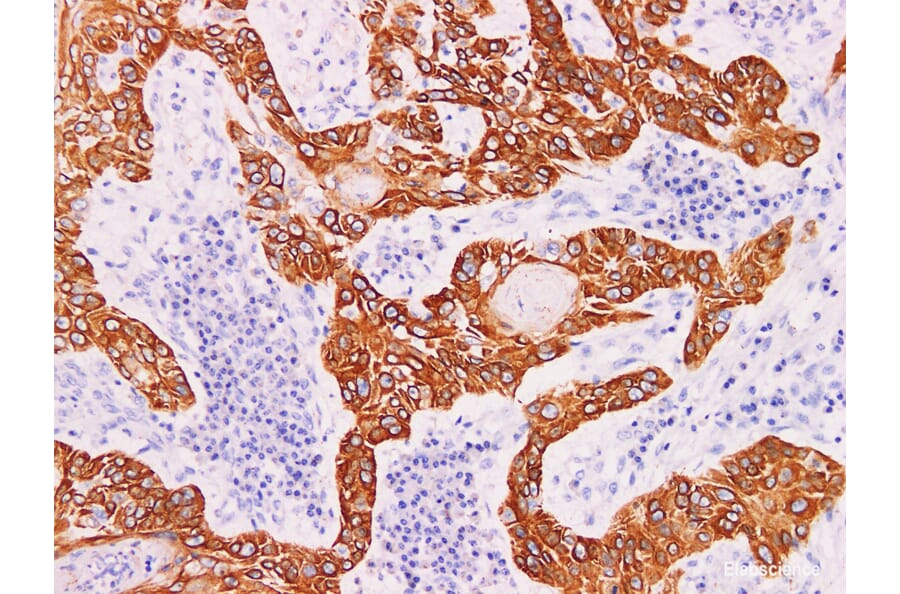 Validation Data - Anti-Cytokeratin 5 Antibody [YN00586m] (A288804)