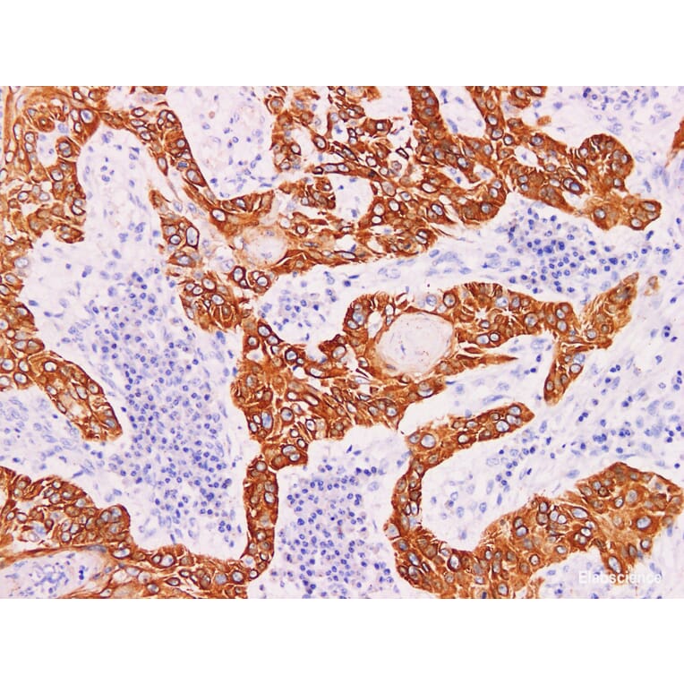 Validation Data - Anti-Cytokeratin 5 Antibody [YN00586m] (A288804)