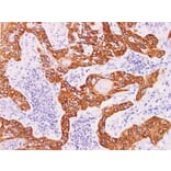 Validation Data - Anti-Cytokeratin 5 Antibody [YN00586m] (A288804)