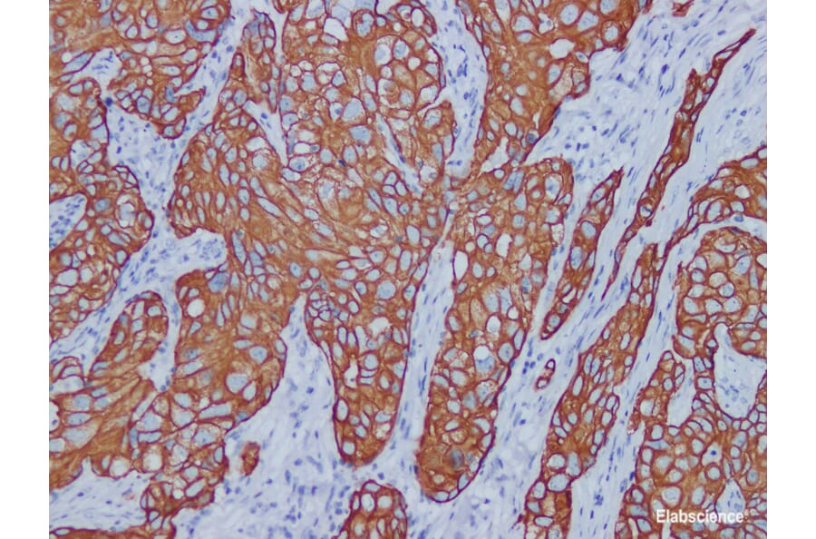 Validation Data - Anti-Cytokeratin 7 Antibody [YN00615m] (A288805)