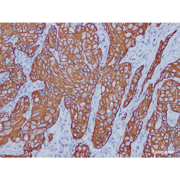 Validation Data - Anti-Cytokeratin 7 Antibody [YN00615m] (A288805)