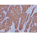 Validation Data - Anti-Cytokeratin 7 Antibody [YN00615m] (A288805)