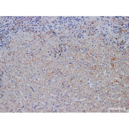 Validation Data - Anti-E-Cadherin Antibody [YN00775m] (A288806)