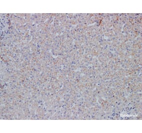 Validation Data - Anti-E-Cadherin Antibody [YN00775r] (A288807)
