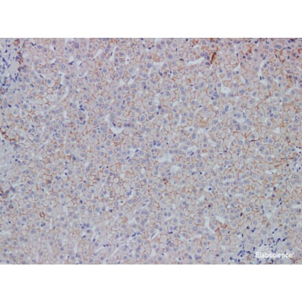 Validation Data - Anti-E-Cadherin Antibody [YN00775r] (A288807)