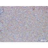 Validation Data - Anti-E-Cadherin Antibody [YN00775r] (A288807)