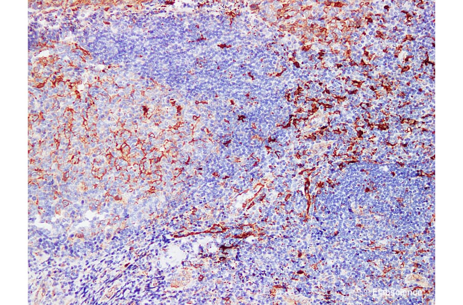 Validation Data - Anti-Fascin Antibody [YN00826m] (A288808)
