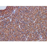 Validation Data - Anti-Glial Fibrillary Acidic Protein(GFAP) Antibody [YN00865m] (A288809)