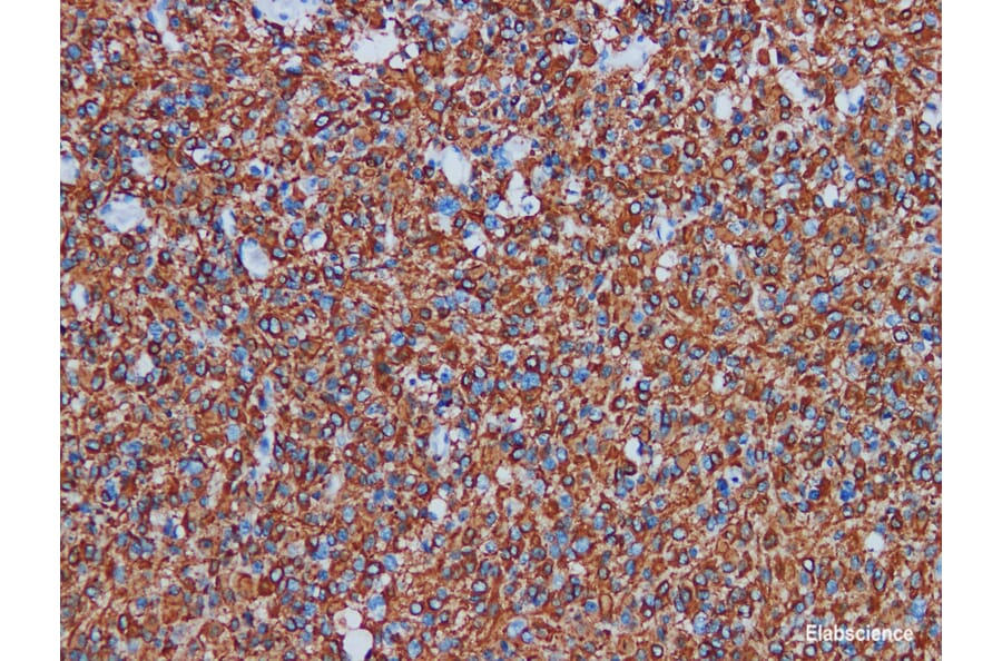 Validation Data - Anti-Glial Fibrillary Acidic Protein(GFAP) Antibody [YN00865r] (A288810)