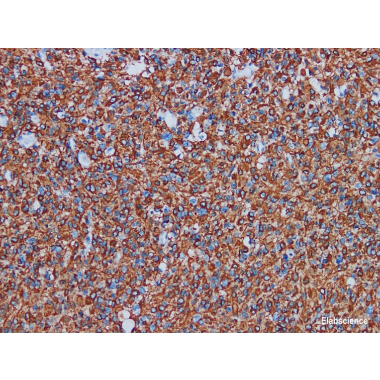 Validation Data - Anti-Glial Fibrillary Acidic Protein(GFAP) Antibody [YN00865r] (A288810)