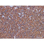 Validation Data - Anti-Glial Fibrillary Acidic Protein(GFAP) Antibody [YN00865r] (A288810)