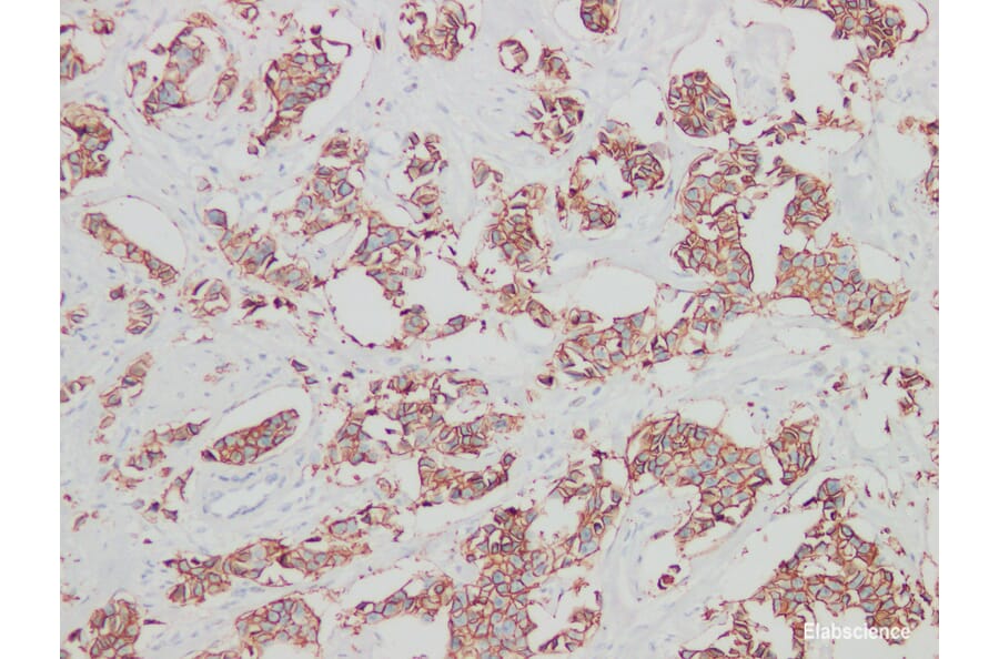 Validation Data - Anti-Her-2 Antibody [YN00955m] (A288811)