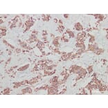 Validation Data - Anti-Her-2 Antibody [YN00955m] (A288811)