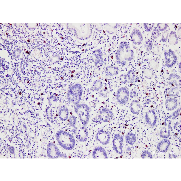 Validation Data - Anti-Mast cell tryptase(MCT) Antibody [YN01036m] (A288814)