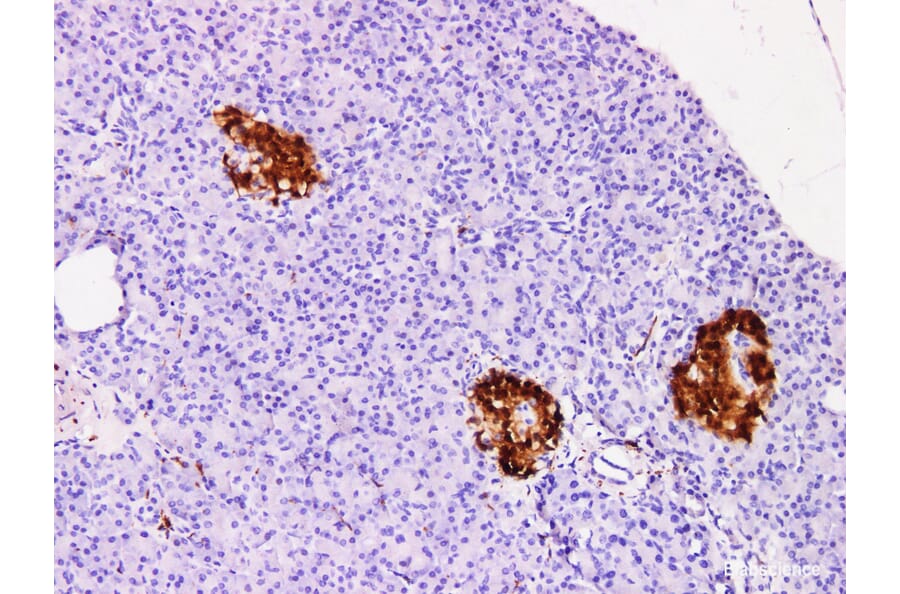 Validation Data - Anti-Protein Gene Product 9.5(PGP 9.5) Antibody [YN01316m] (A288815)