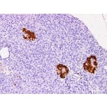 Validation Data - Anti-Protein Gene Product 9.5(PGP 9.5) Antibody [YN01316m] (A288815)