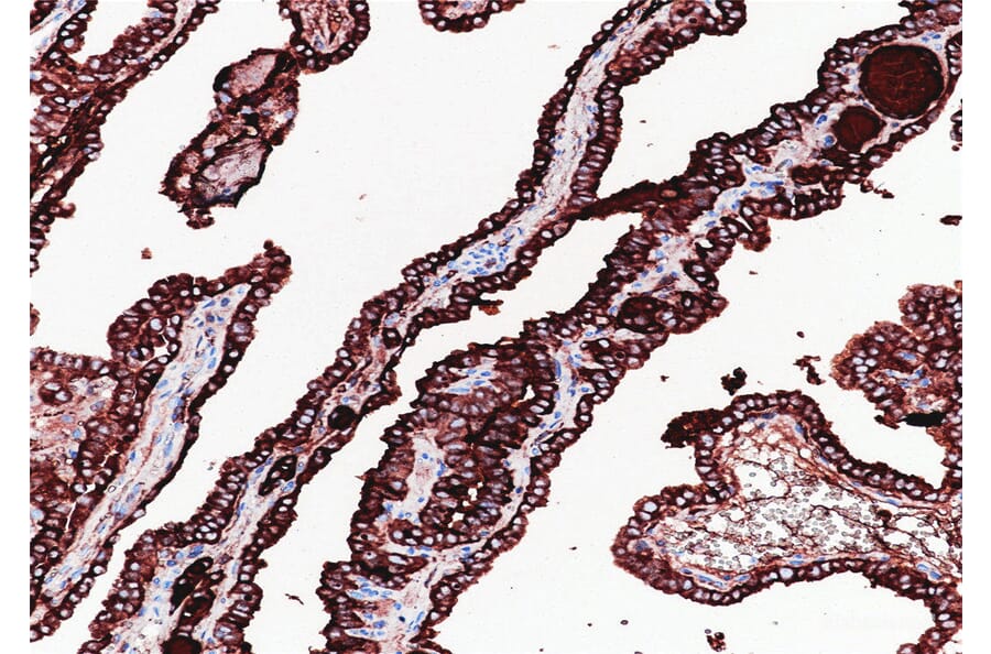 Validation Data - Anti-Thyroglobulin(TG) Antibody [YN01585m] (A288816)