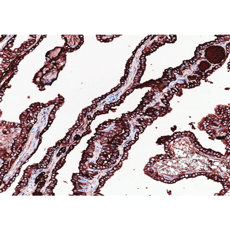 Validation Data - Anti-Thyroglobulin(TG) Antibody [YN01585m] (A288816)
