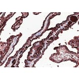 Validation Data - Anti-Thyroglobulin(TG) Antibody [YN01585m] (A288816)