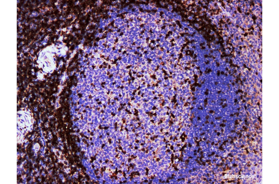 Validation Data - Anti-ZAP-70 Antibody [YN01716m] (A288817)