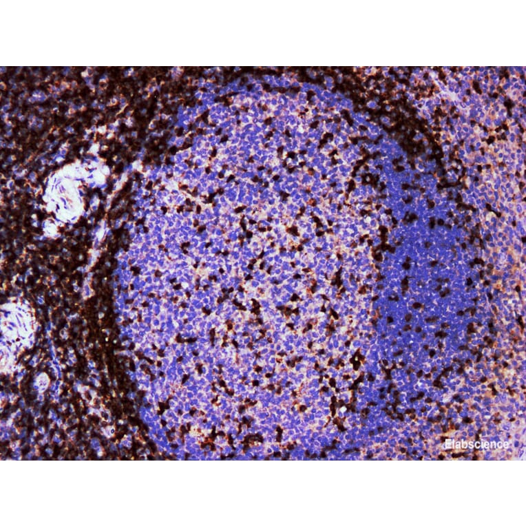 Validation Data - Anti-ZAP-70 Antibody [YN01716m] (A288817)