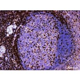 Validation Data - Anti-ZAP-70 Antibody [YN01716m] (A288817)