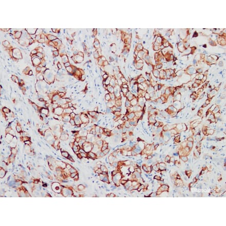 Validation Data - Anti-GCDFP-15 Antibody [YN00896m] (A288819)