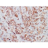 Validation Data - Anti-GCDFP-15 Antibody [YN00896m] (A288819)