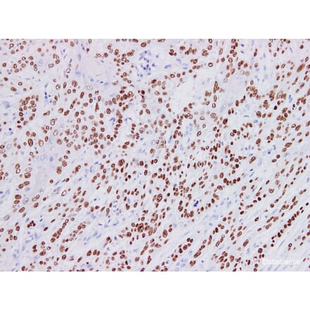 Validation Data - Anti-p40 Antibody [YN01235m] (A288820)