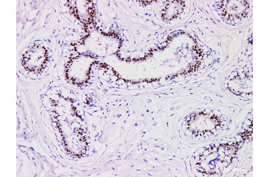Validation Data - Anti-Progesterone Receptor(PR) Antibody [YN01365m] (A288821)
