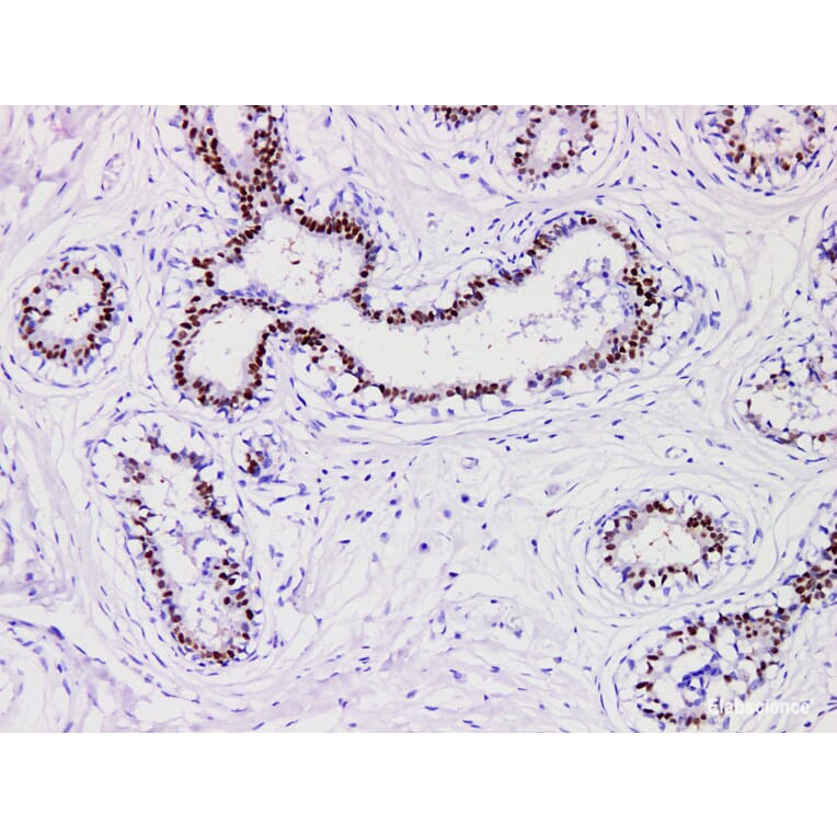 Validation Data - Anti-Progesterone Receptor(PR) Antibody [YN01365m] (A288821)