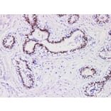 Validation Data - Anti-Progesterone Receptor(PR) Antibody [YN01365m] (A288821)