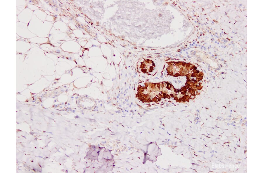 Validation Data - Anti-S100A6 Antibody [YN01486m] (A288822)