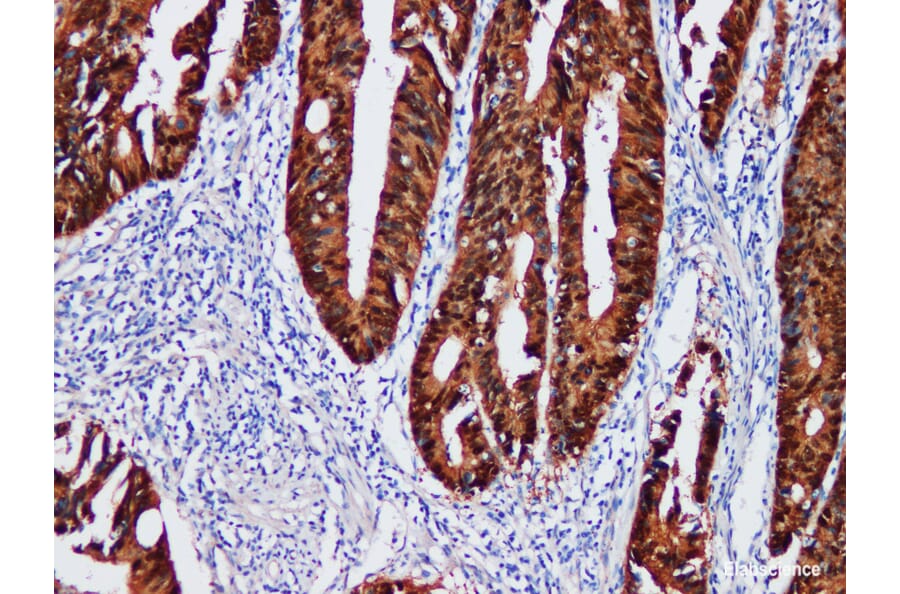 Validation Data - Anti-Beta-catenin Antibody [YN00106m] (A288823)
