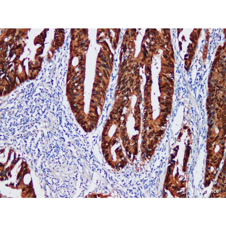 Validation Data - Anti-Beta-catenin Antibody [YN00106m] (A288823)